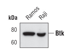 Btk Antibody in Western Blot (WB)
