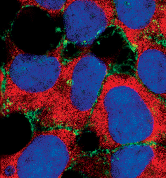 alpha N-Catenin Antibody in Immunocytochemistry (ICC/IF)