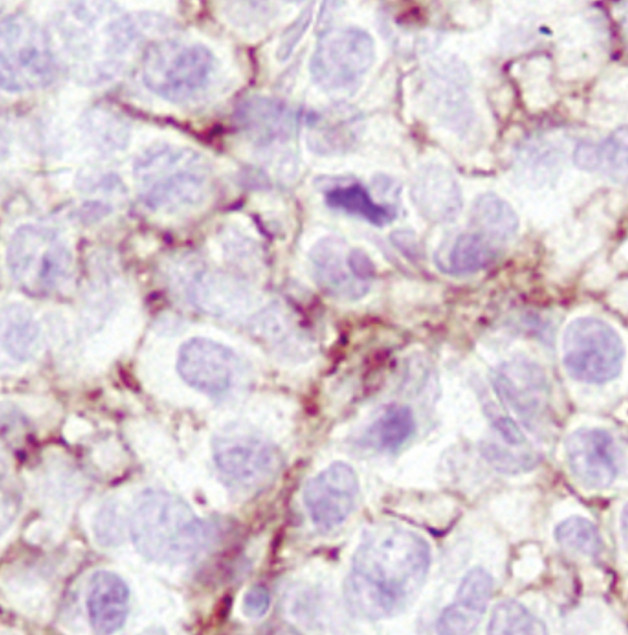 Phospho-Ezrin (Thr567)/Radixin (Thr564)/Moesin (Thr558) Antibody in Immunohistochemistry (IHC)