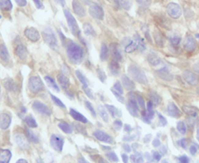 beta Tubulin Antibody in Immunohistochemistry (IHC)