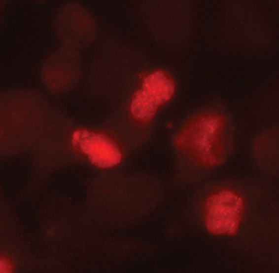 Caspase 8 (Cleaved Asp391) Antibody in Immunocytochemistry (ICC/IF)