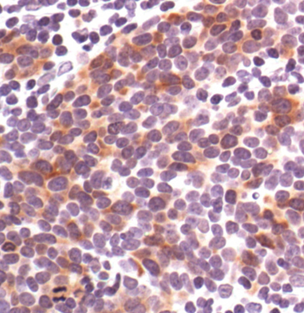 Phospho-Cdc25C (Ser216) Antibody in Immunohistochemistry (Paraffin) (IHC (P))