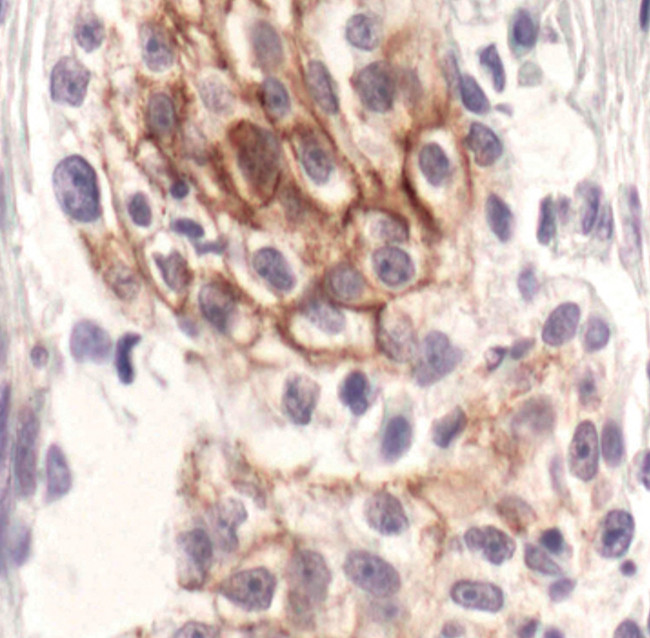 Phospho-ErbB3 (Tyr1289) Antibody in Immunohistochemistry (Paraffin) (IHC (P))