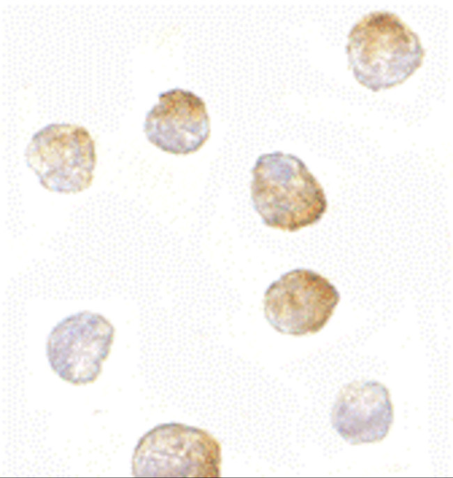 Bim Antibody in Immunocytochemistry (ICC/IF)