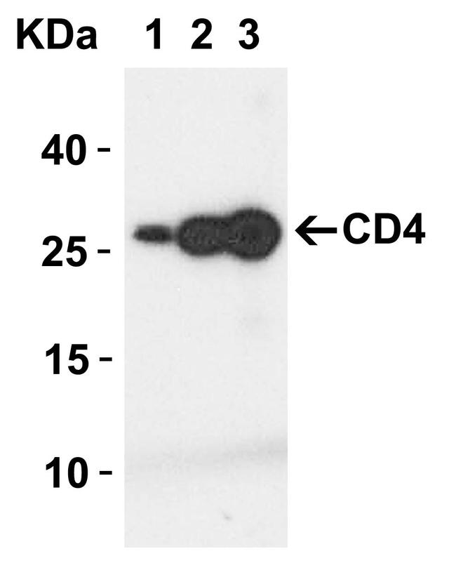 CD4 Antibody in Western Blot (WB)