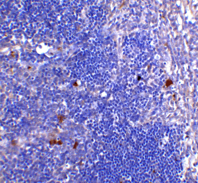 CD4 Antibody in Immunohistochemistry (Paraffin) (IHC (P))