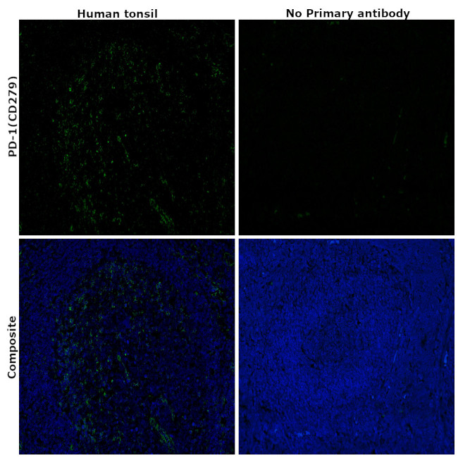 PD-1 Antibody in Immunohistochemistry (Paraffin) (IHC (P))