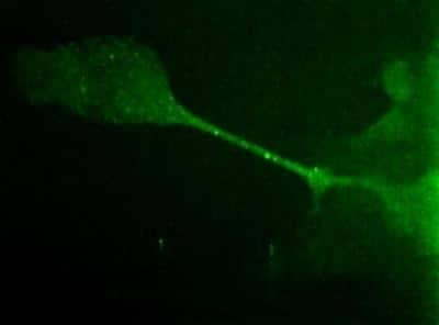 Desmoglein 3 Antibody in Immunocytochemistry (ICC/IF)