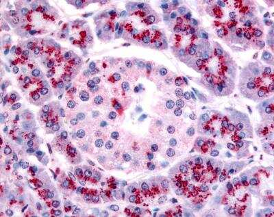 TERT Antibody in Immunohistochemistry (Paraffin) (IHC (P))