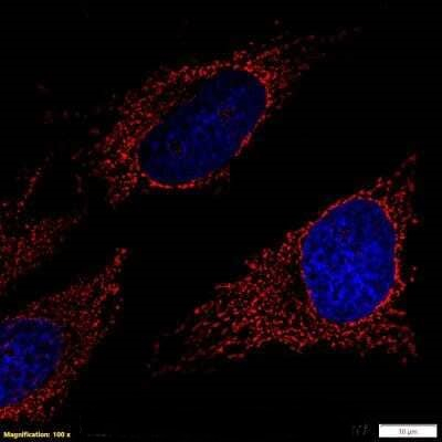 rRNA Antibody in Immunocytochemistry (ICC/IF)