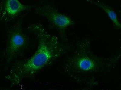 Tenascin C Antibody in Immunocytochemistry (ICC/IF)