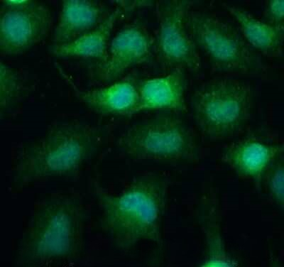 Podoplanin Antibody in Immunocytochemistry (ICC/IF)
