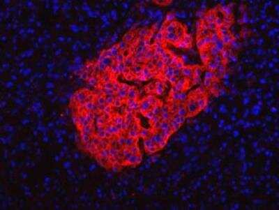 HPi2 Antibody in Immunocytochemistry (ICC/IF)
