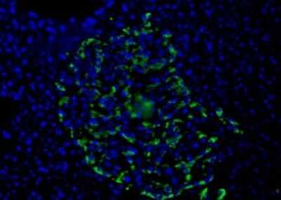 HPa1 Antibody in Immunocytochemistry (ICC/IF)