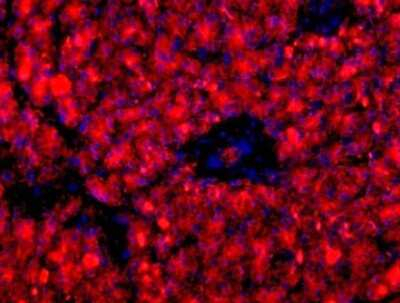 HPx1 Antibody in Immunocytochemistry (ICC/IF)
