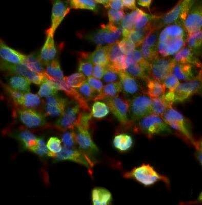 IkB alpha Antibody in Immunocytochemistry (ICC/IF)