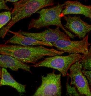 IKK alpha Antibody in Immunocytochemistry (ICC/IF)