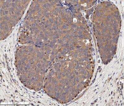 p73 Antibody in Immunohistochemistry (Paraffin) (IHC (P))