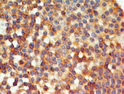 TLR6 Antibody in Immunohistochemistry (Paraffin) (IHC (P))