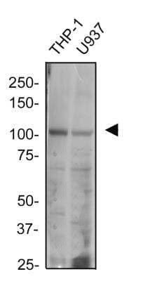 TLR2 Antibody in Western Blot (WB)