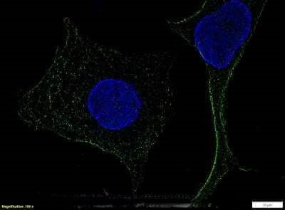 TLR4 Antibody in Immunocytochemistry (ICC/IF)