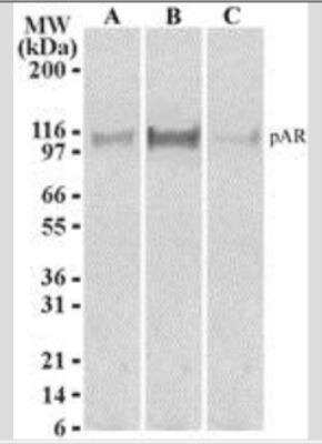 Phospho-Androgen Receptor (Ser213, Ser210) Antibody in Western Blot (WB)