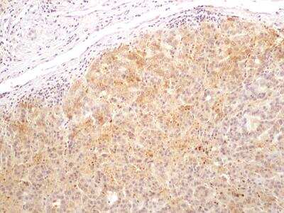 Bi-1 Antibody in Immunohistochemistry (Paraffin) (IHC (P))