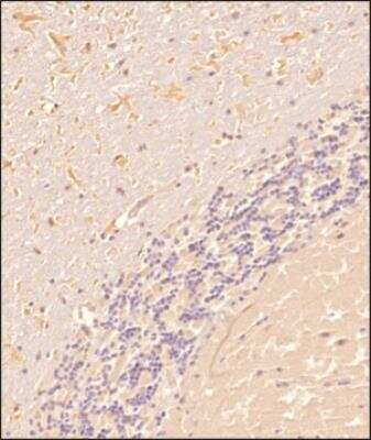 TLR7 Antibody in Immunohistochemistry (Paraffin) (IHC (P))