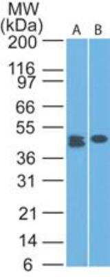 CLEC9A Antibody in Western Blot (WB)