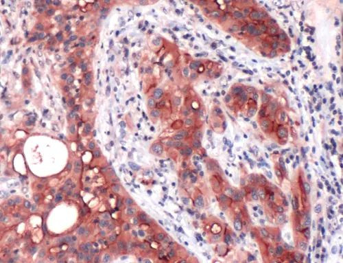 Mesothelin Antibody in Immunohistochemistry (Paraffin) (IHC (P))