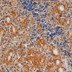 TSH Receptor Antibody in Immunohistochemistry (Paraffin) (IHC (P))