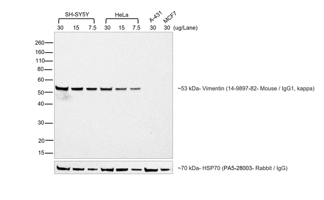 Mouse IgG1 (Heavy chain) Secondary Antibody in Western Blot (WB)