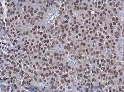 HNF1A Antibody in Immunohistochemistry (Paraffin) (IHC (P))