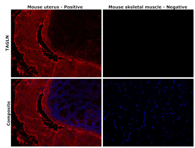 TAGLN Antibody in Immunohistochemistry (Paraffin) (IHC (P))