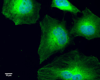 GCP4 Antibody in Immunocytochemistry (ICC/IF)