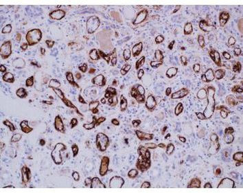 Complement C4d Antibody in Immunohistochemistry (Paraffin) (IHC (P))