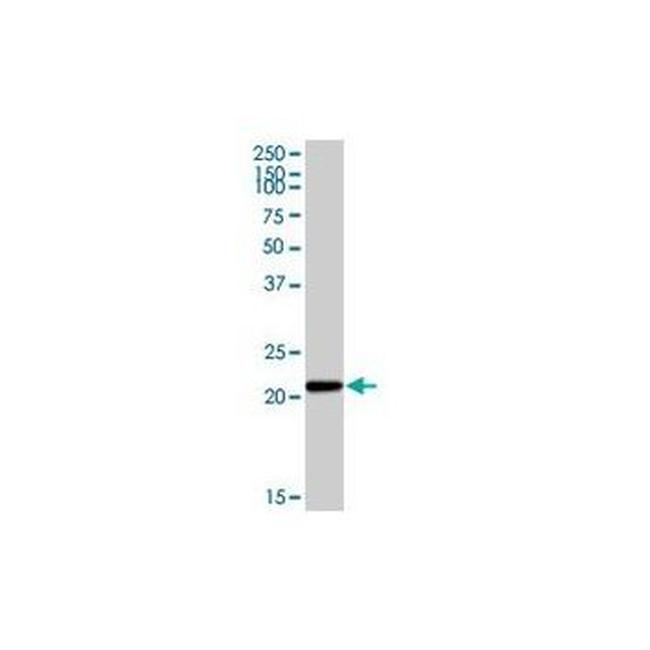 CYBA Antibody in Western Blot (WB)
