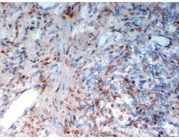 CD33 Antibody in Immunohistochemistry (Frozen) (IHC (F))
