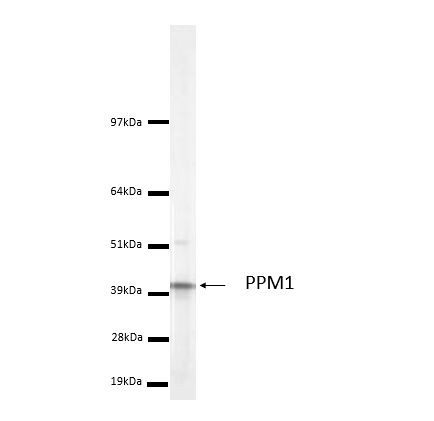 LCMT1 Antibody in Western Blot (WB)