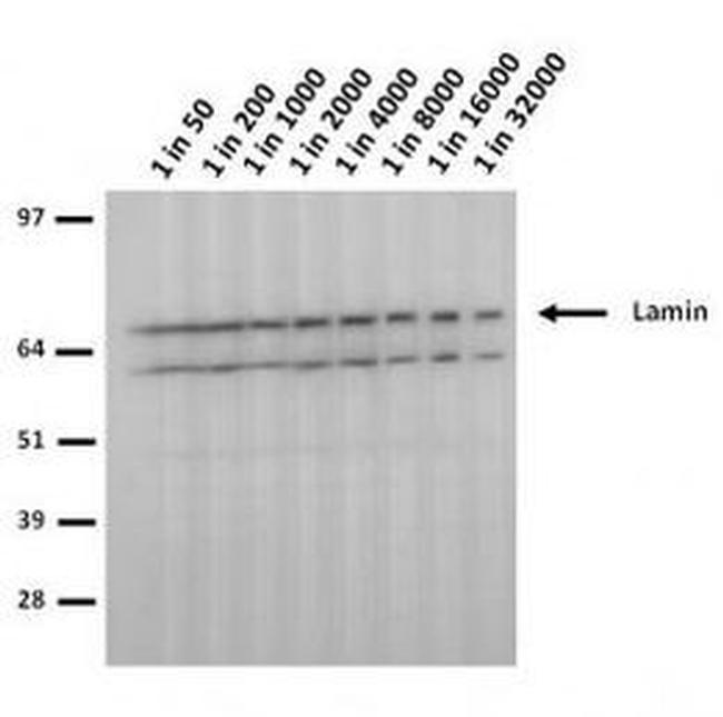 Lamin A/C (R453W) Antibody in Western Blot (WB)