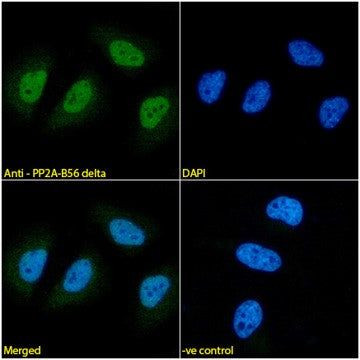 PPP2R5D Antibody in Immunocytochemistry (ICC/IF)