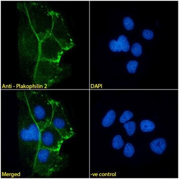 PKP2 Antibody in Immunocytochemistry (ICC/IF)
