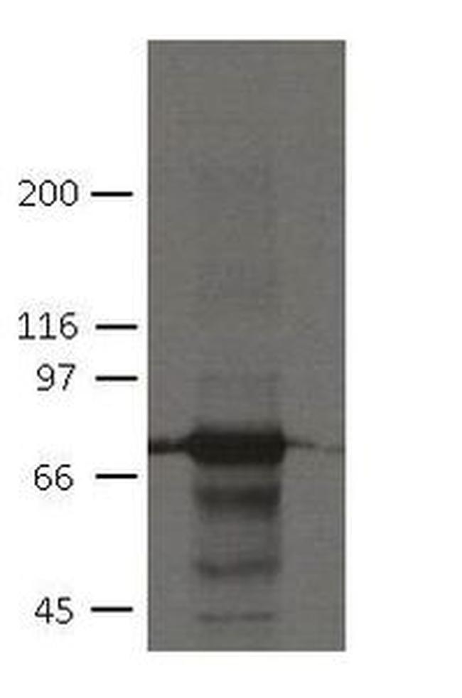 PKP1 Antibody in Western Blot (WB)