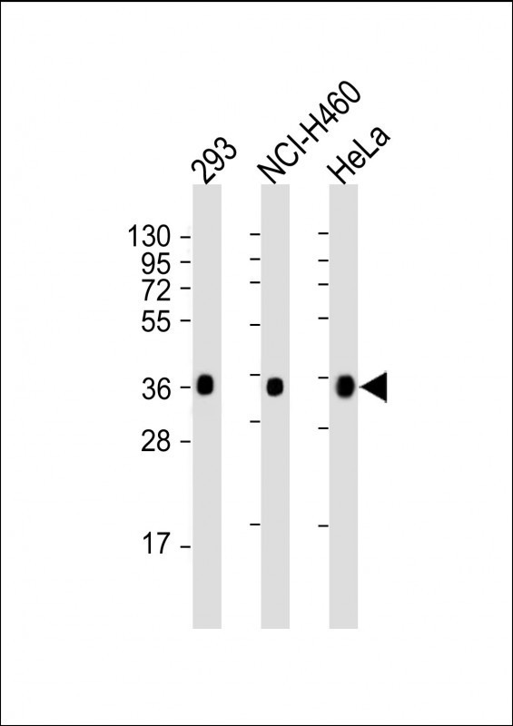 UCH37 Antibody in Western Blot (WB)