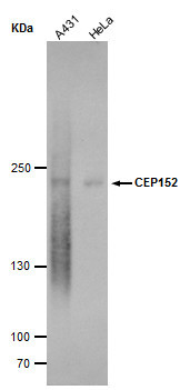 CEP152 Antibody in Western Blot (WB)