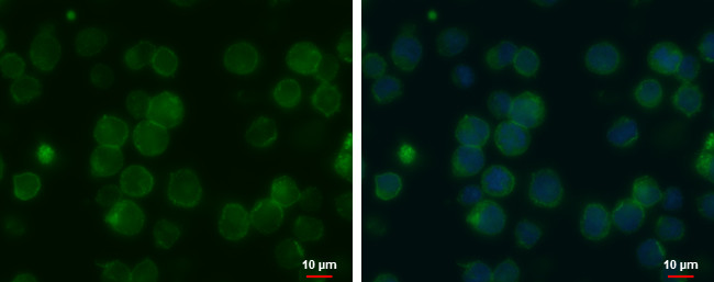 MCT1 Antibody in Immunocytochemistry (ICC/IF)