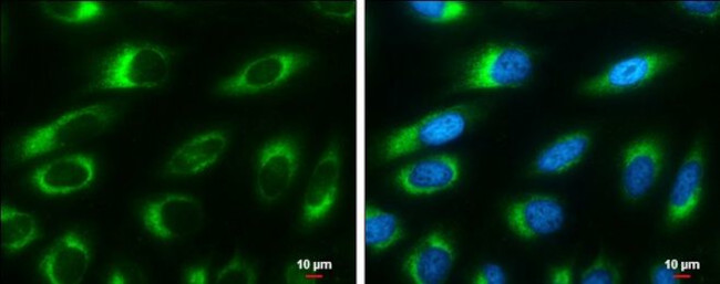 RRBP1 Antibody in Immunocytochemistry (ICC/IF)