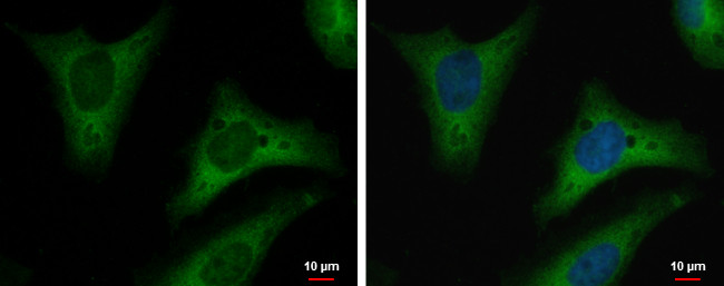 TPI1 Antibody in Immunocytochemistry (ICC/IF)