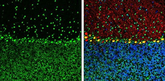 ARID5A Antibody in Immunohistochemistry (Frozen) (IHC (F))