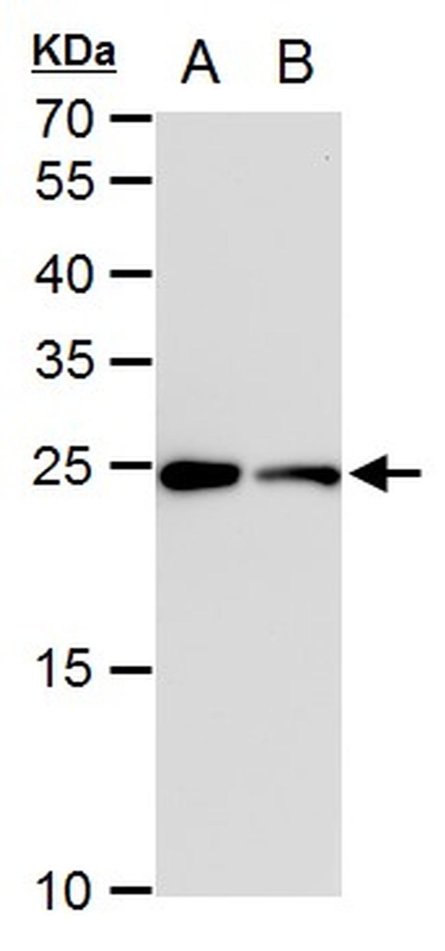 TPI1 Antibody in Western Blot (WB)